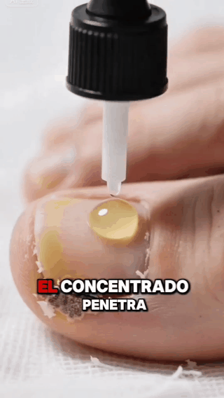 Elimina el Hongo de Raíz